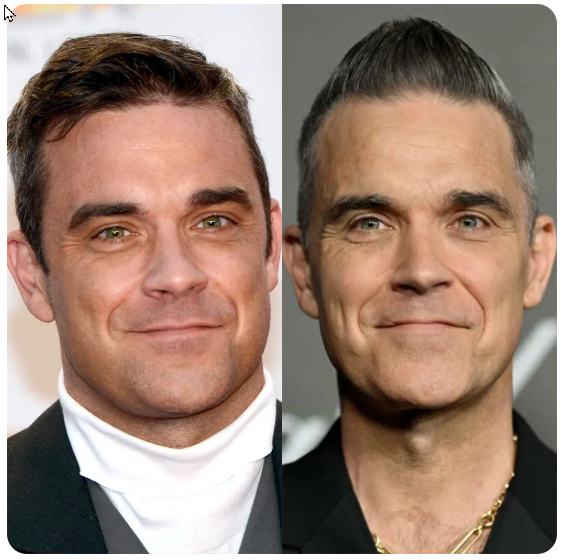 Ritratto di Robbie Williams, sorridente, con pettinatura e abbigliamento diversi.